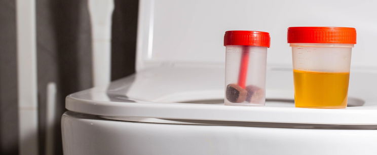 Itt a figyelmeztetés, kiderült az otthoni wc-k szörnyű titka, ezért kell lehajtani mindig a fedelüket használat után