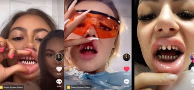 A legújabb TikTok trend: hegyesre fent cápafogakkal vicsorognak a fiatal lányok